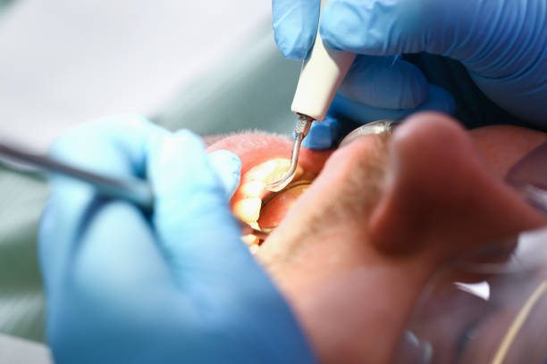Best Emergency Gum Pain Relief  in Mckee City, NJ